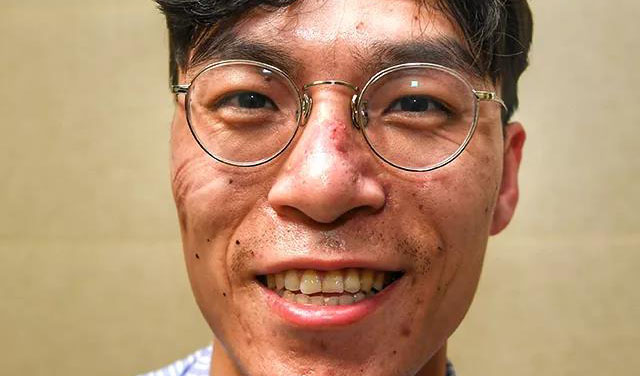 這些刻在我們臉上的印痕，會成為永恒的記憶！